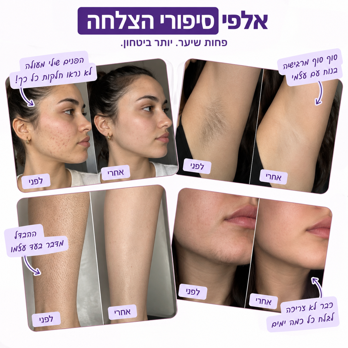 תמונת מוצר נוספת של שמן SlowGrow מבית Glowy